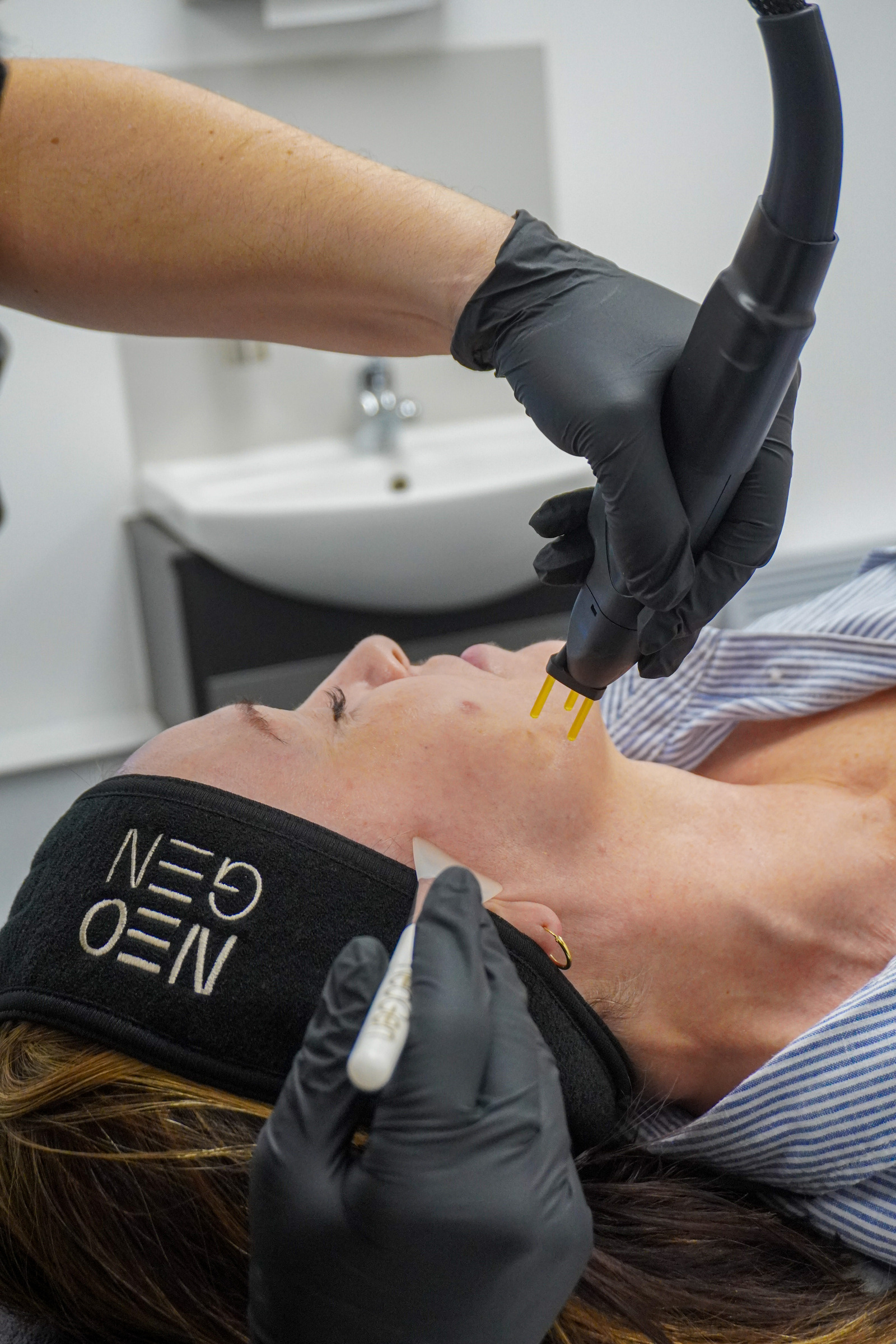 NEOGEN nitrogen plasma treatment at eLIVEate Me, Buckinghamshire