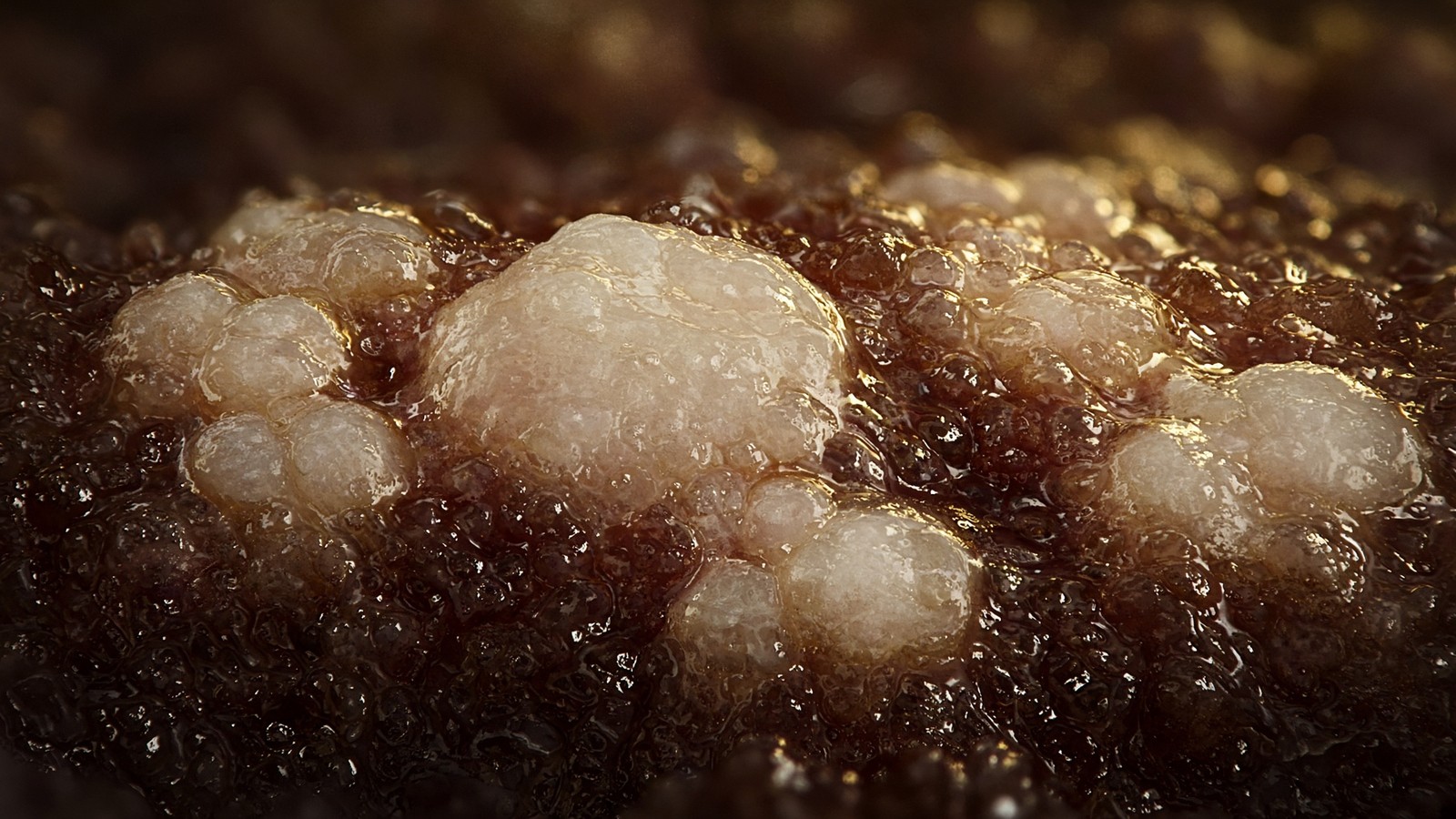 Liver and pancreatic fat — the twin-cycle biology behind type 2 diabetes remission